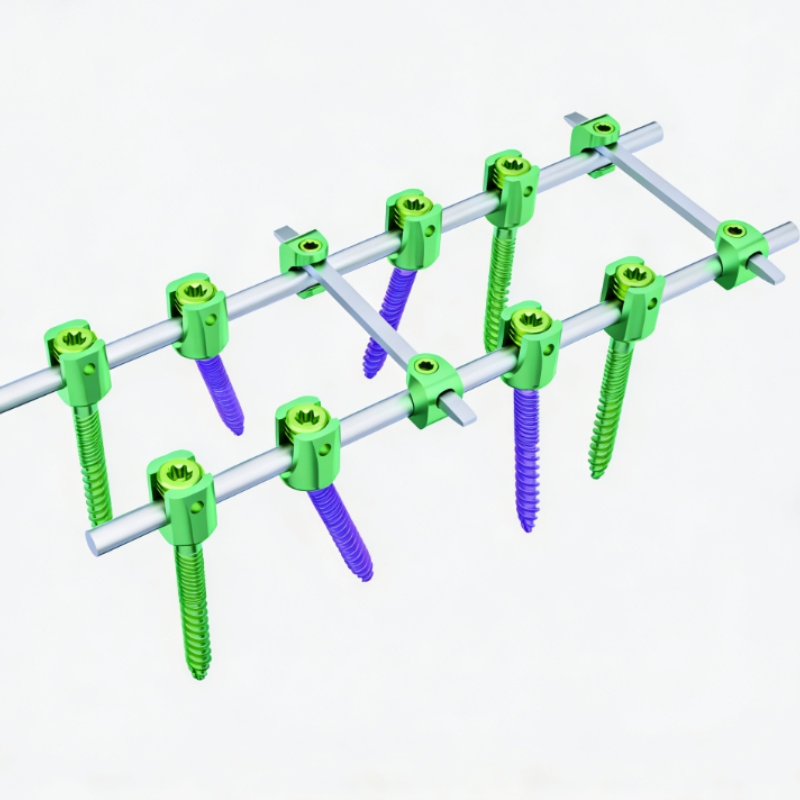 Spine System Medical Reduction Pedicle Screw I Orthopedic Surgical Spine Implants Mini Implant