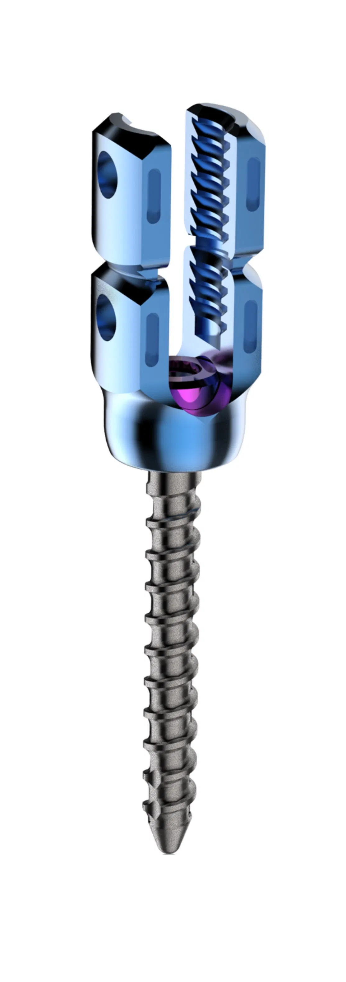 Advanced Titanium Posterior Rod-Screw System for Spinal Correction