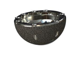 3D Printer Biocompatible Porous Titanium Alloy Implant with Corrosion Resistance