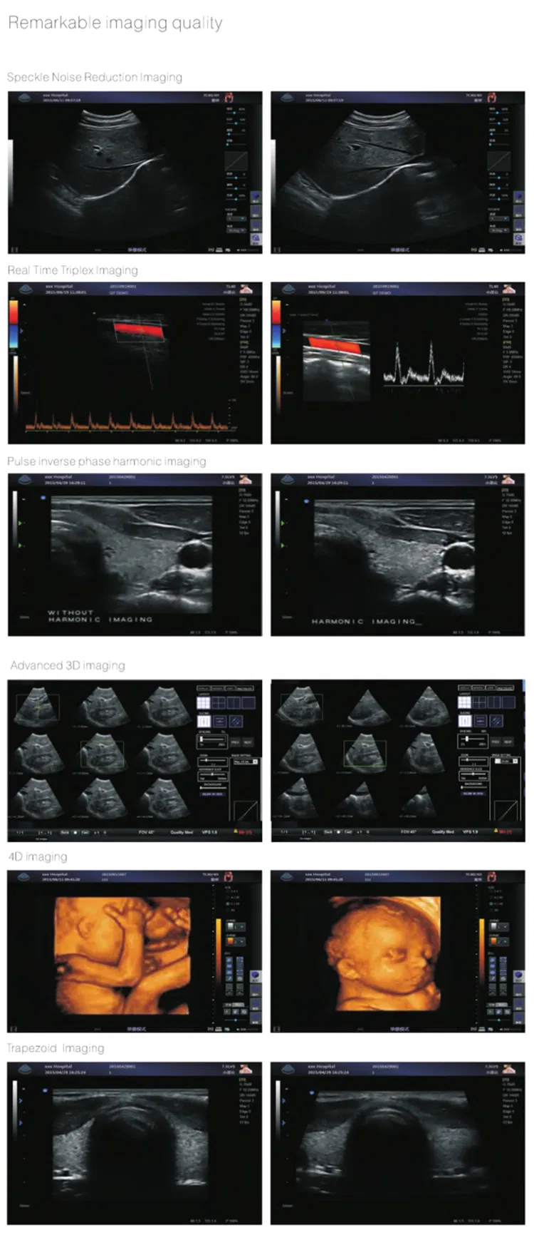 Ultrasound System View 3