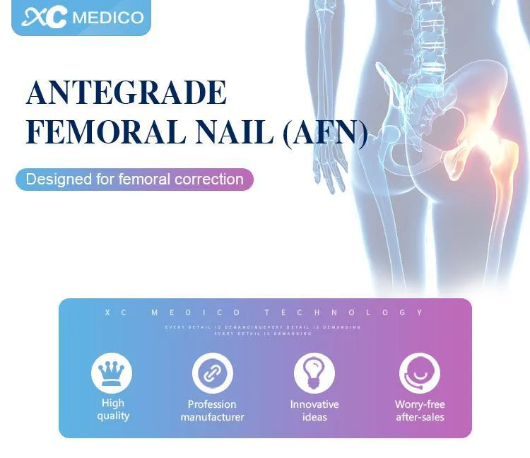 Orthopedic Implants Reversed Femoral Intramedullary Nails