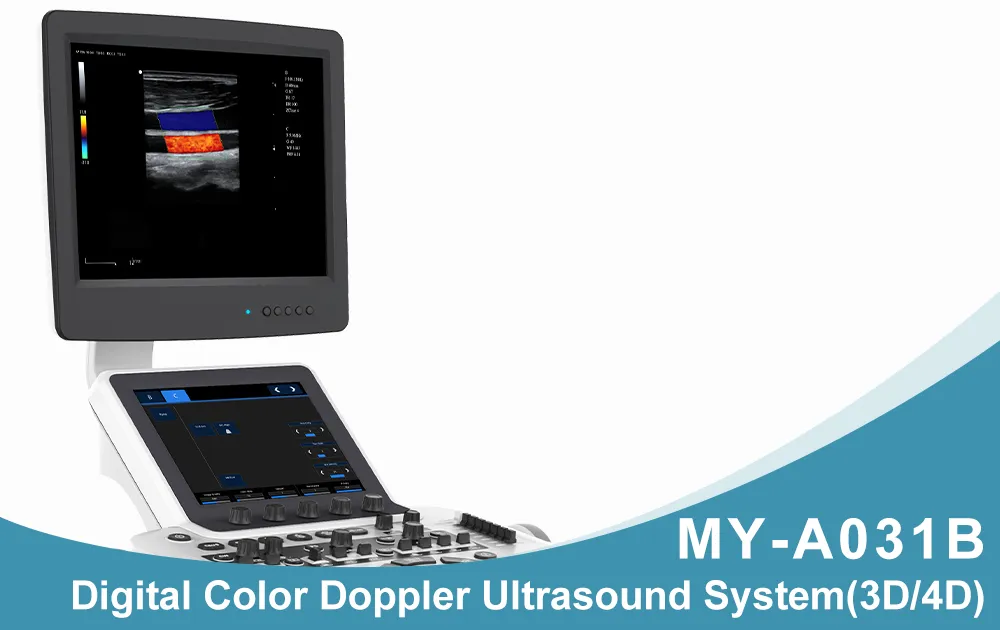 Ultrasound System Overview