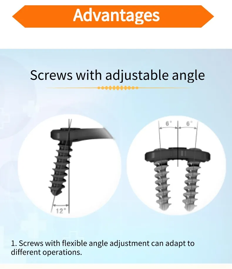 Spinal Fixation Details