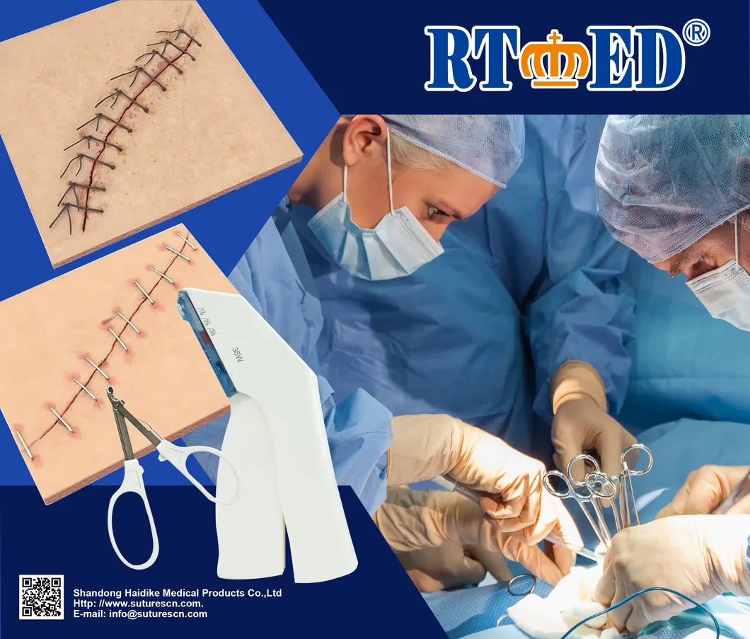 Disposable Surgical Skin Stapler 1