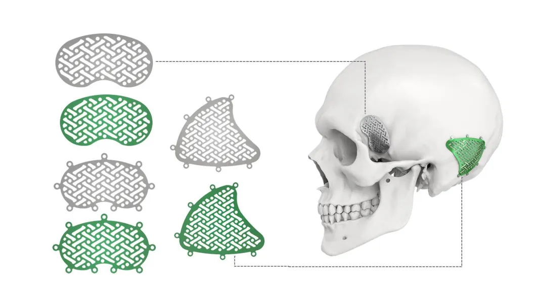 Medical Titanium Screws