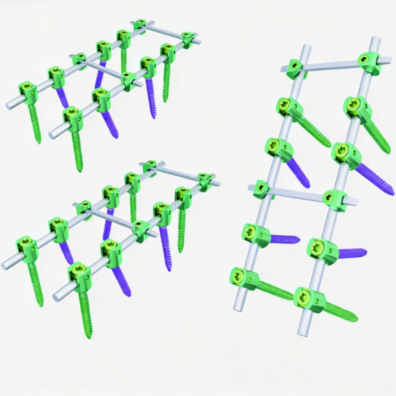 Spine System Medical Reduction Pedicle Screw I Orthopedic Surgical Spine Implants Mini Implant