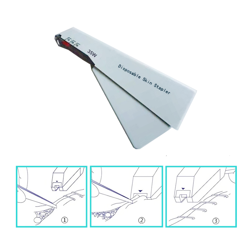 Disposable Simple Use Automatic Stainless Steel Surgical Operation Medical Suture 35W Skin Stapler with Pin Remover