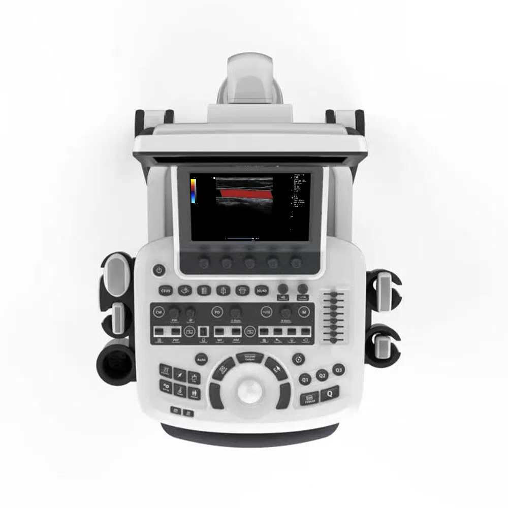 Digital Color Doppler Ultrasound System (3D/4D)