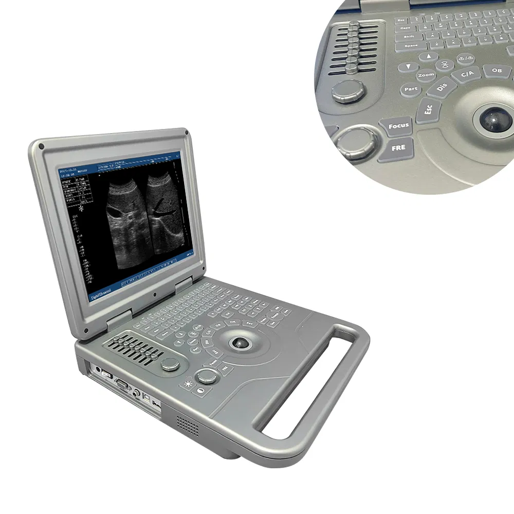 Vet Ultrasound Machine Linear Probe Full Digital Veterinary Ultrasound System