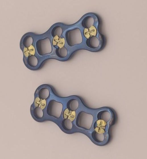 Spinal Implant Titanium Spinal Series Anterior Cervical Plates