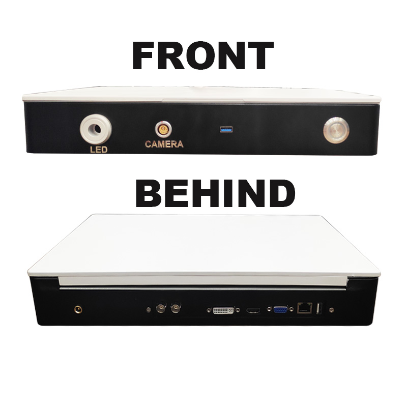 Portable HD Endoscope Camera System with 15" Display and LED Light Source