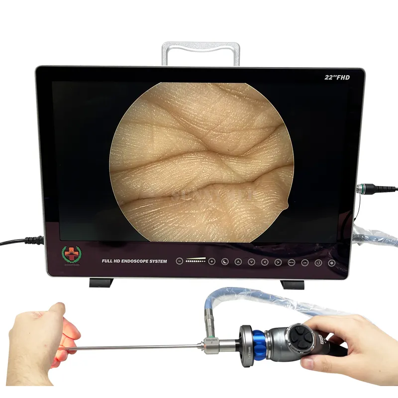 Full HD Video Endoscope System