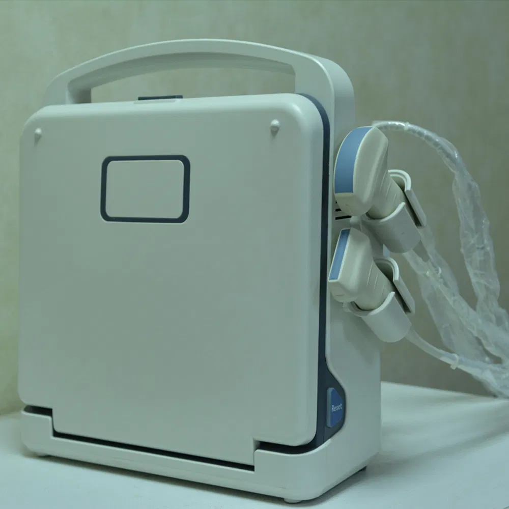 Full Digital Portable Color Doppler Ultrasound Diagnostic System