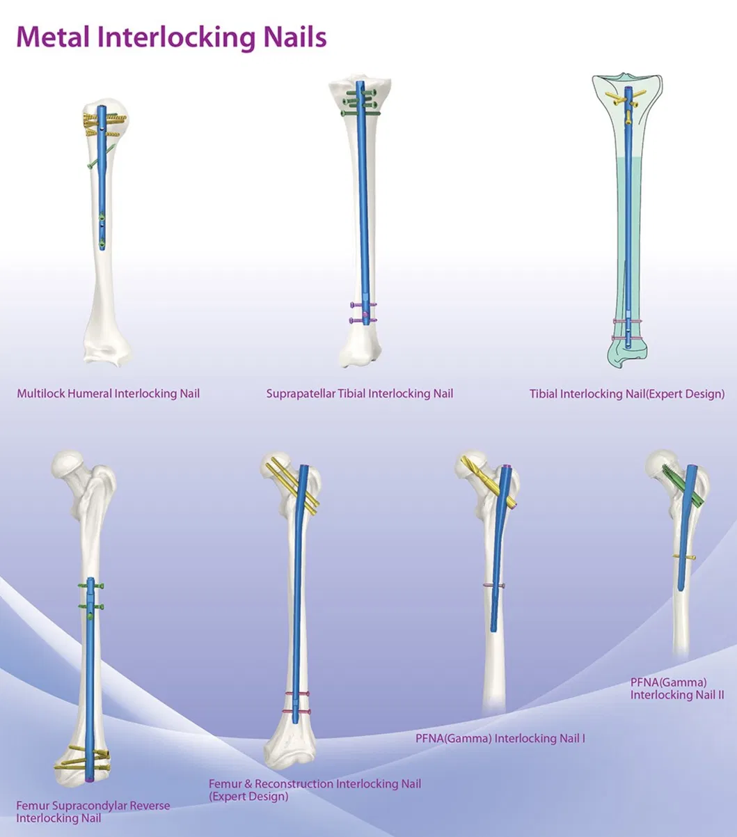Related Orthopedic Product 2