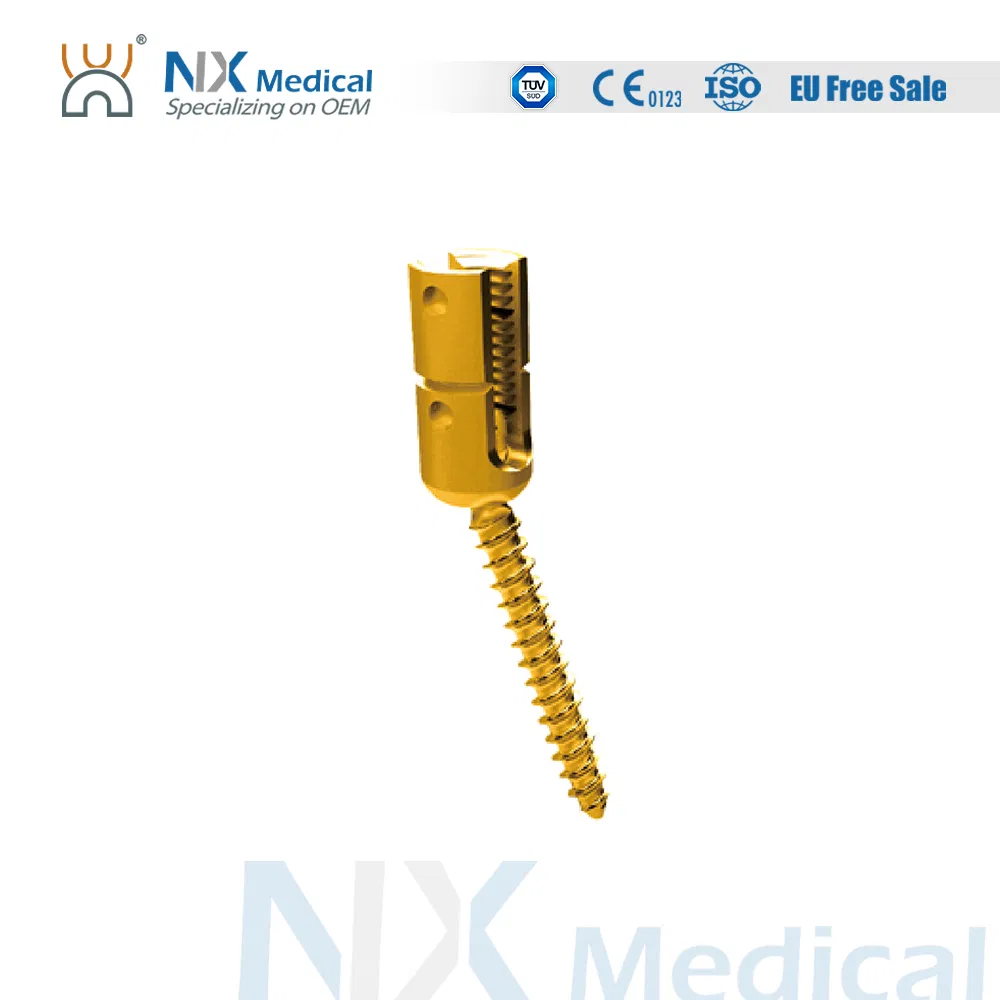 Nx Medical High-Quality Sf-I &amp; Sf-II Spinal Pedicle Screw 6.0mm for Bone Fixation