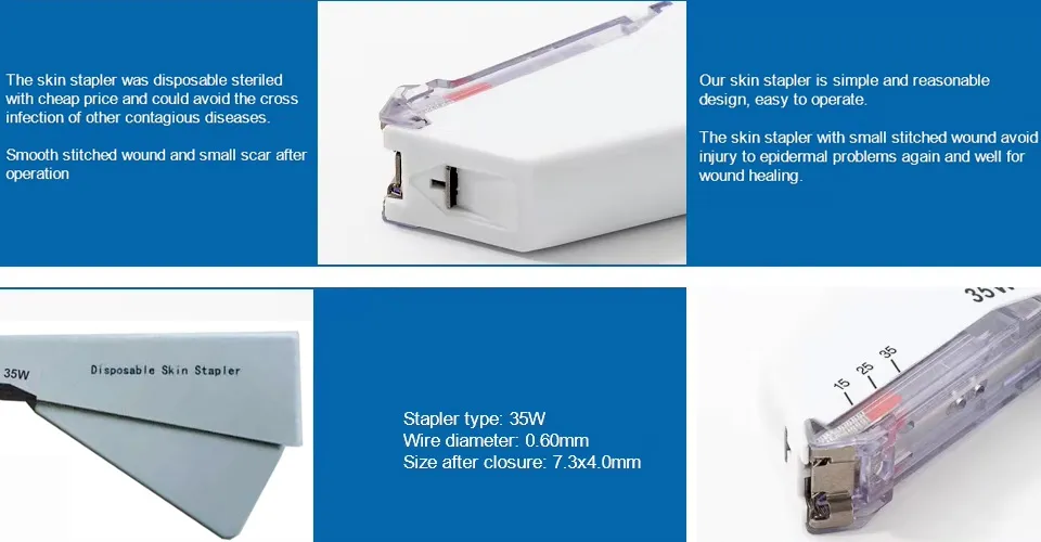 Skin Stapler Mechanism