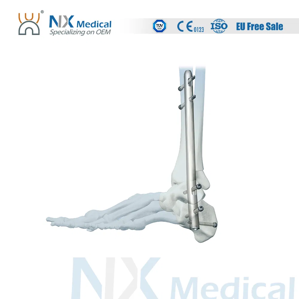 Orthopedic Implant Ankle Fusion Nail Interlocking Intramedullary Nail
