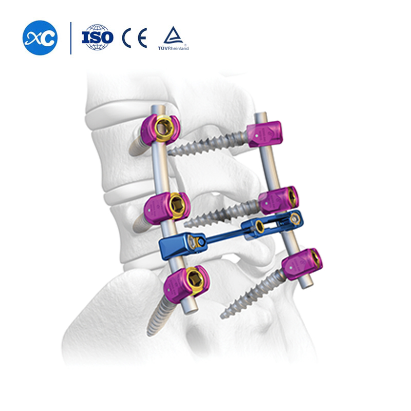 Orthopedic Spine Fixation System Titanium Spinal Implants