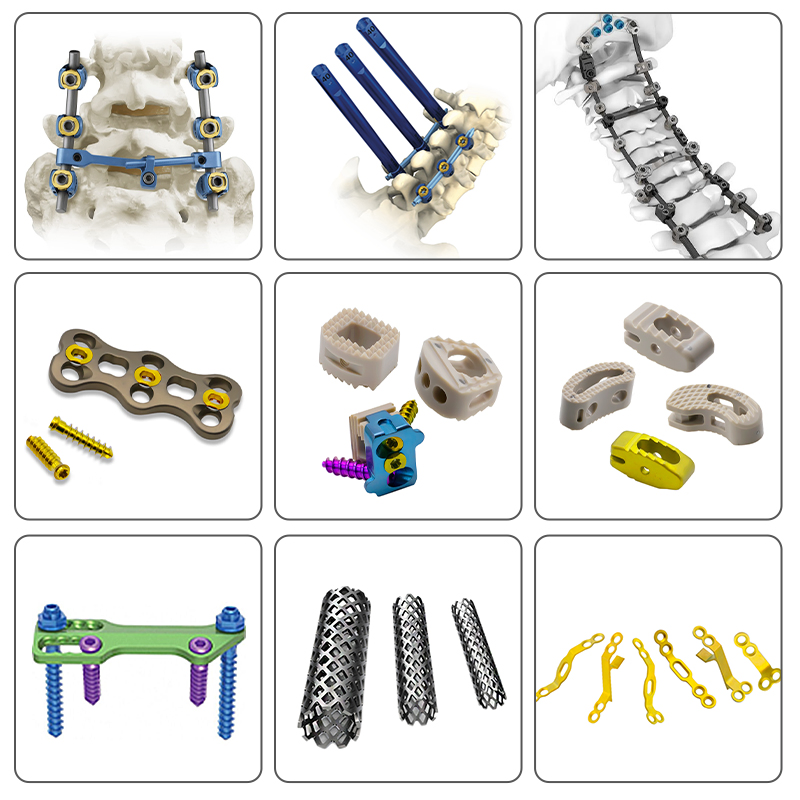 Quality Assured Orthopedic Surgical Implants Domino Bolt for Posterior Cervical Fixation System Spinal Medical Implant