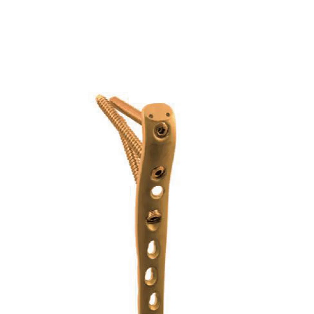 Nx Medical High-Stability Locking Plate Large Fragment Fixation System for Trauma Fixation