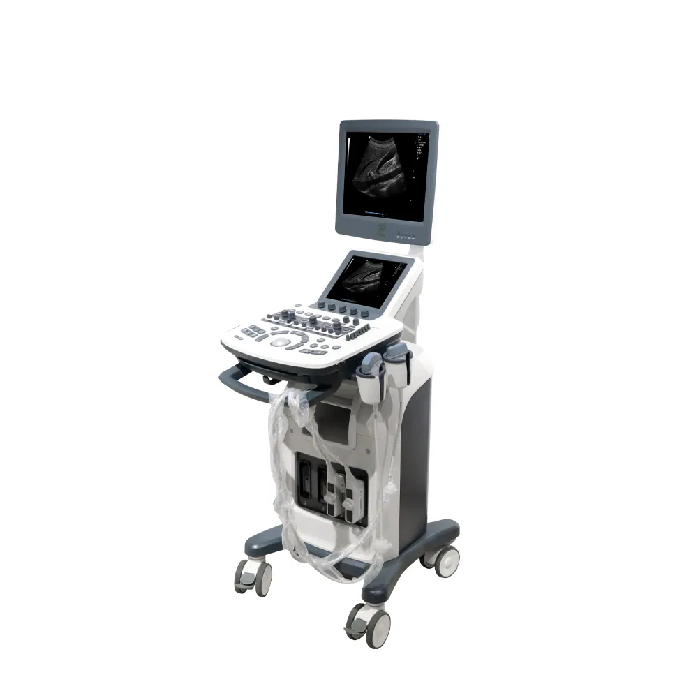 Digital Color Doppler Ultrasound System (3D/4D)