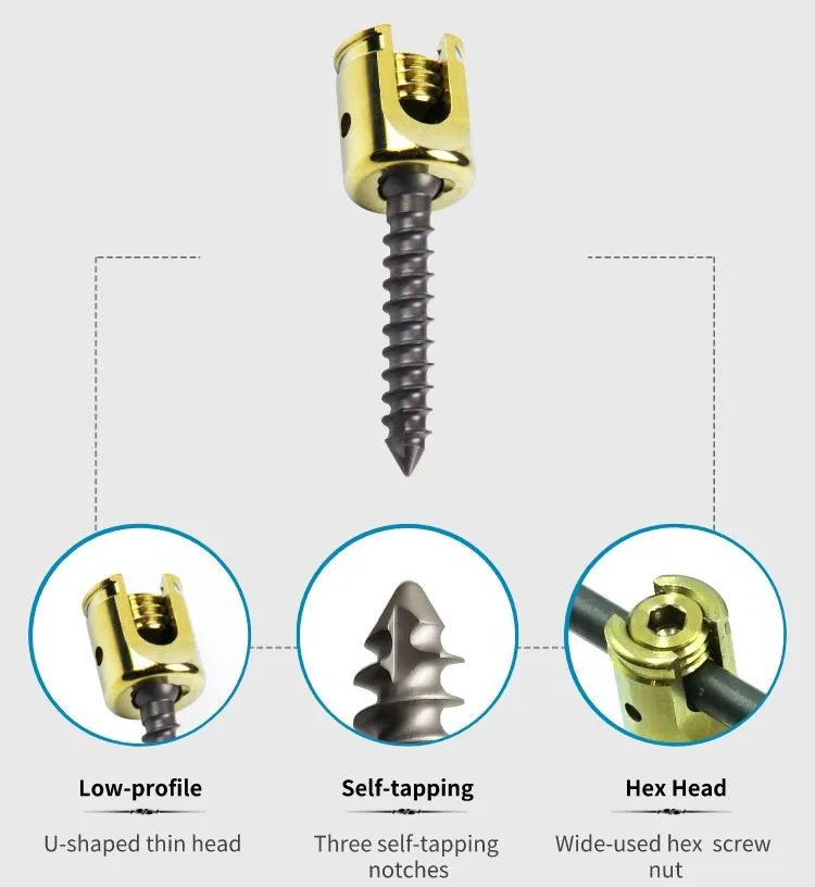 Pedicle Screw Design