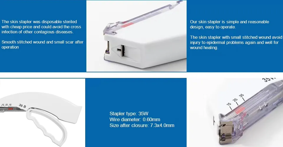 Skin Stapler Details