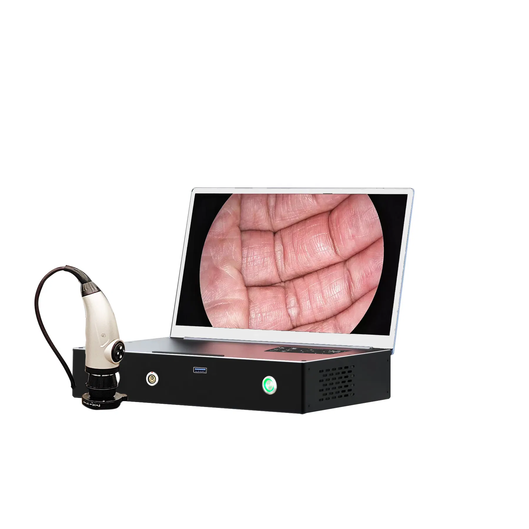 Veterinary Endoscope Camera with Built-in Display and Light