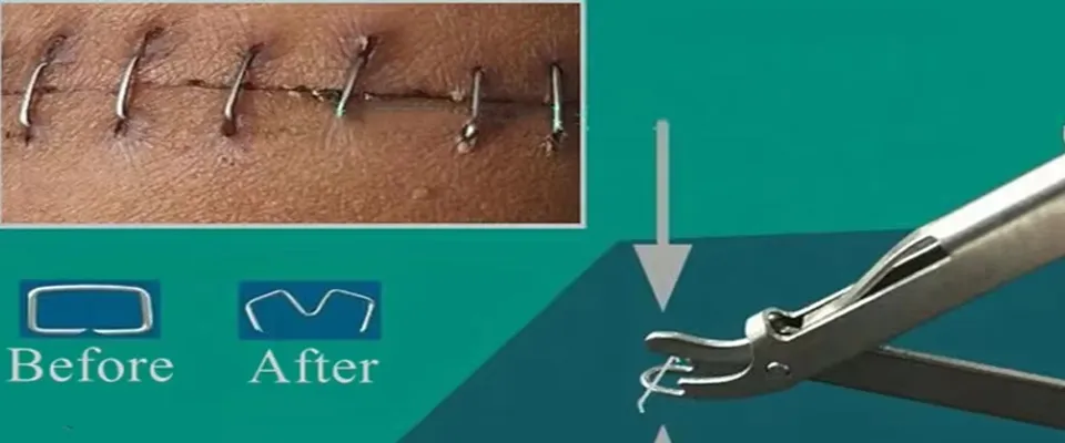 Skin Stapler Specification