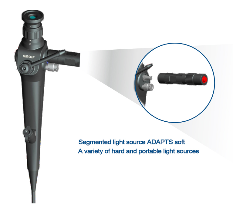 Advanced Ureteroscope Medical Tool for Minimally Invasive Surgeries