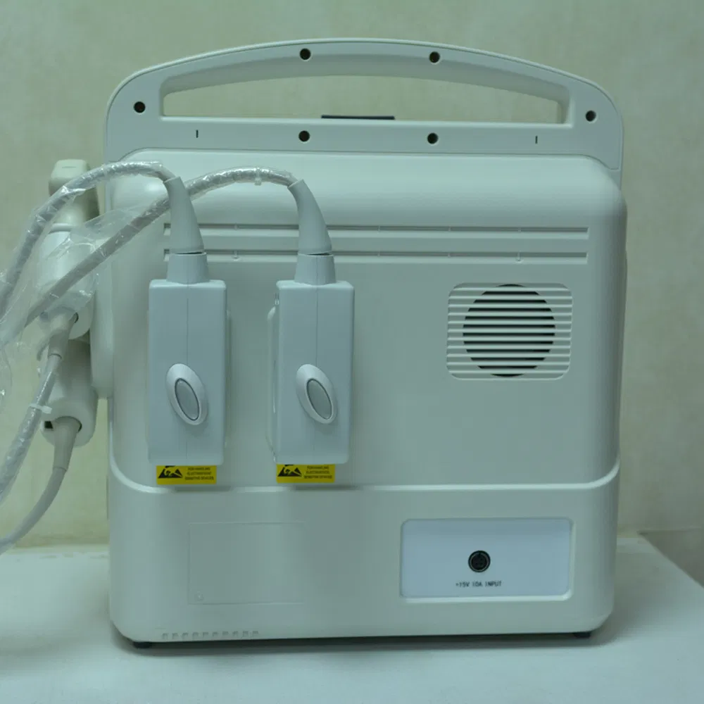 Full Digital Portable Color Doppler Ultrasound Diagnostic System