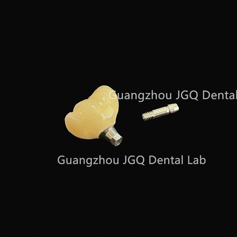 China Dental Lab Implant Product Offers Customizable Solution to Meet The Specific Needs of Each Patient