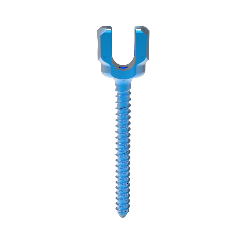 Reliable Cortical Bone Thread Screw for Iliac Fixation