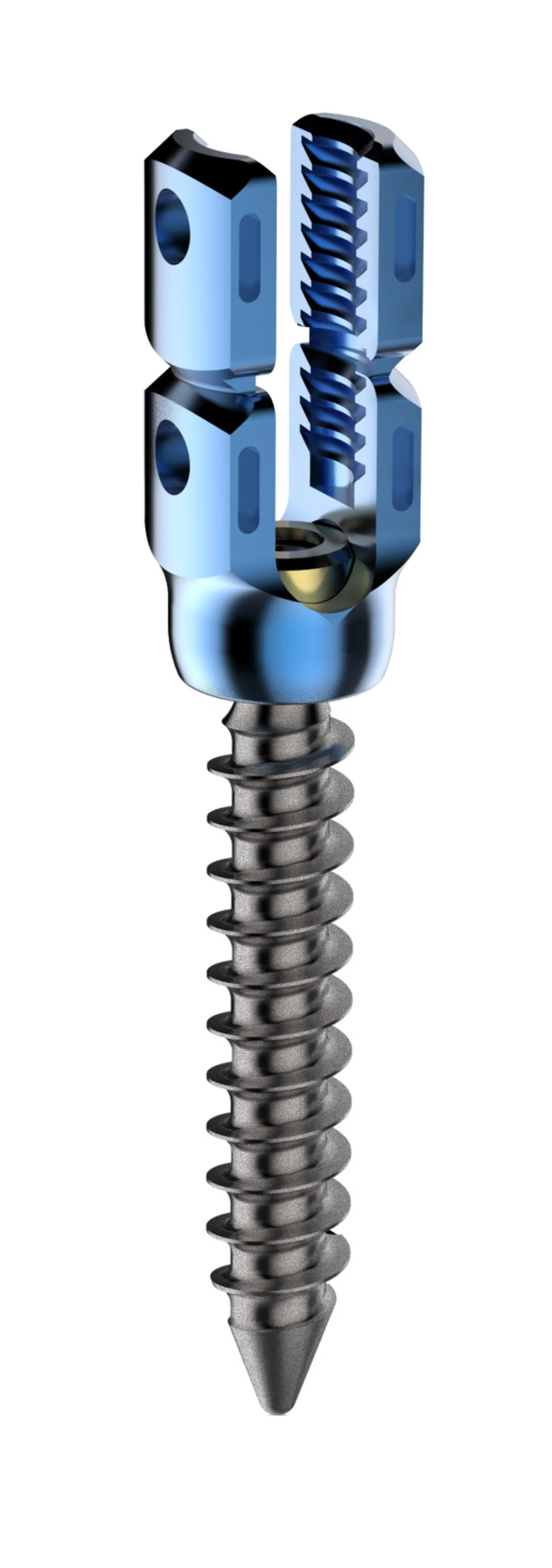 Advanced Titanium Posterior Rod-Screw System for Spinal Correction
