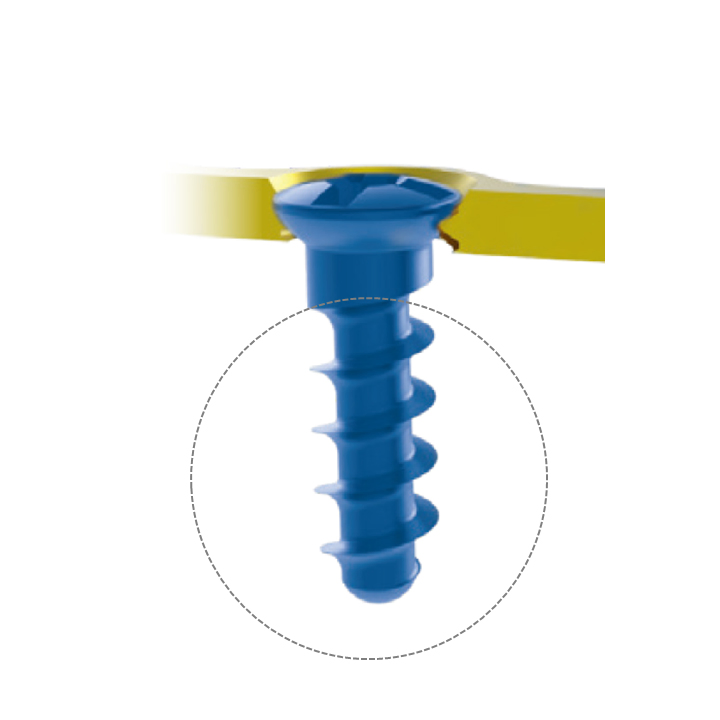 Superior Quality Mandible Trauma Fixation System Locking Plate and Screws