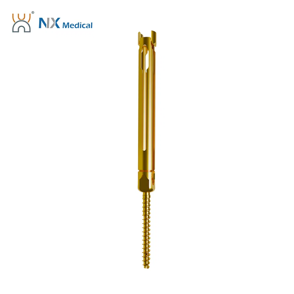 Nx Medical Titanium Cannulated Bone Cement Pedicle Screw 5.5mm Spine Implant