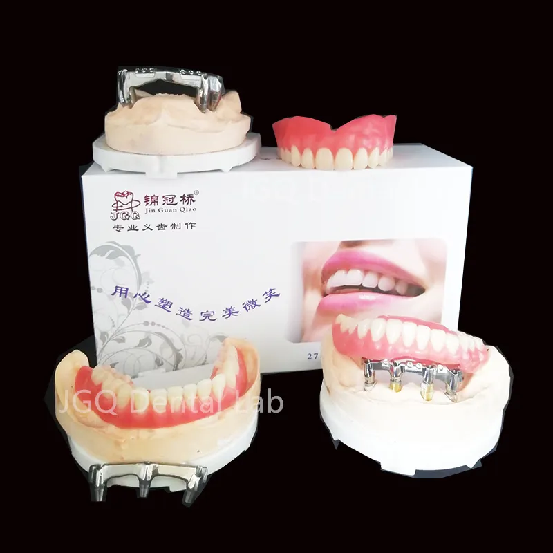 Implant Bar