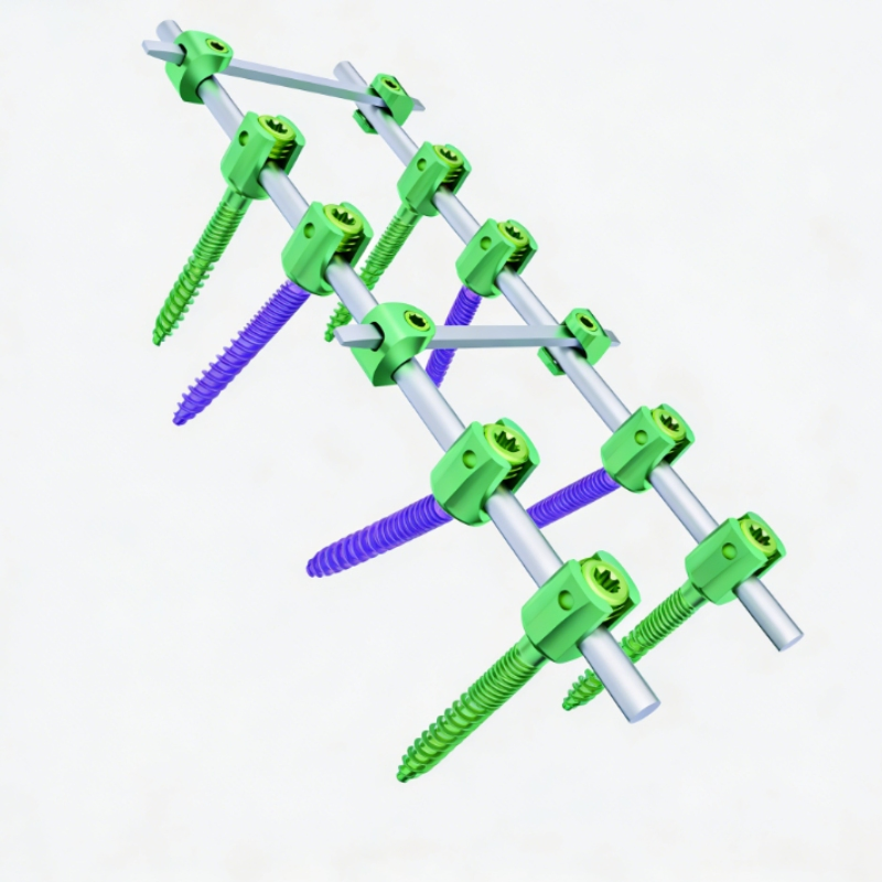 Spine System Medical Reduction Pedicle Screw I Orthopedic Surgical Spine Implants Mini Implant