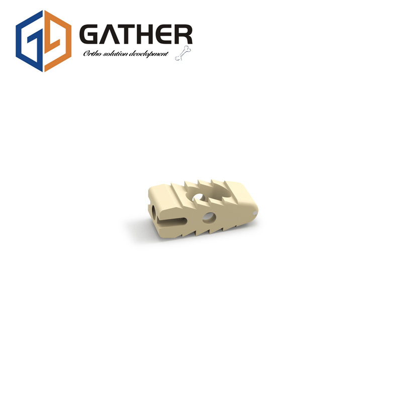 Customized Accepted Fixation Spinal Screws Internal Implant Surgical Spine Pedicle Screw Lumber