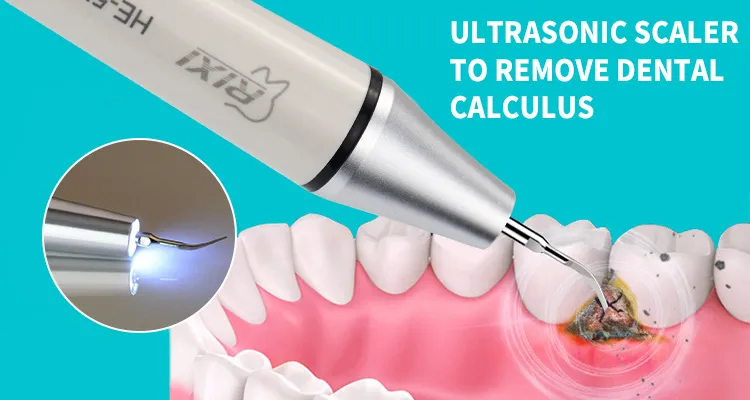 Dental Scaler Detail 2