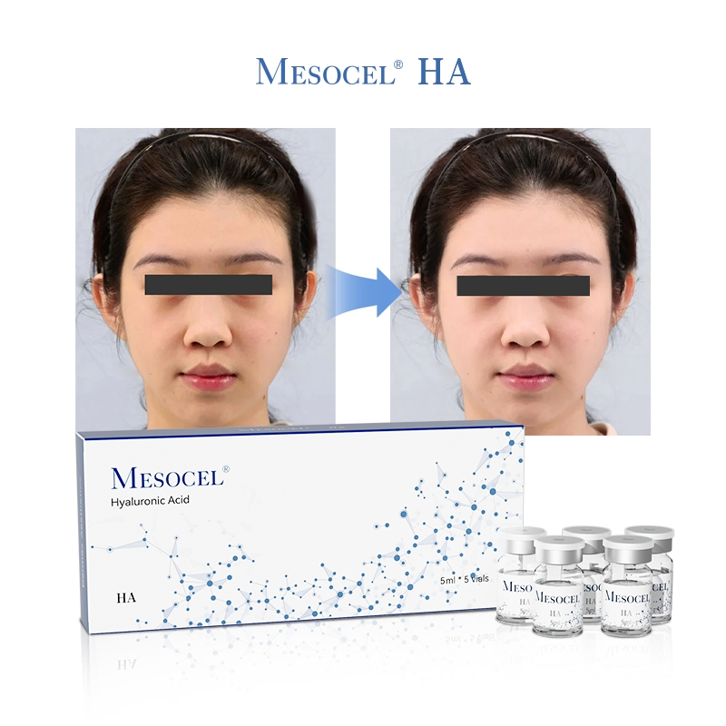 High Quality Face Skincare Beauty Used After Mesotherapy Skin Booster Quick Repair Moisturizing Hyaluronic Acid Ampoules
