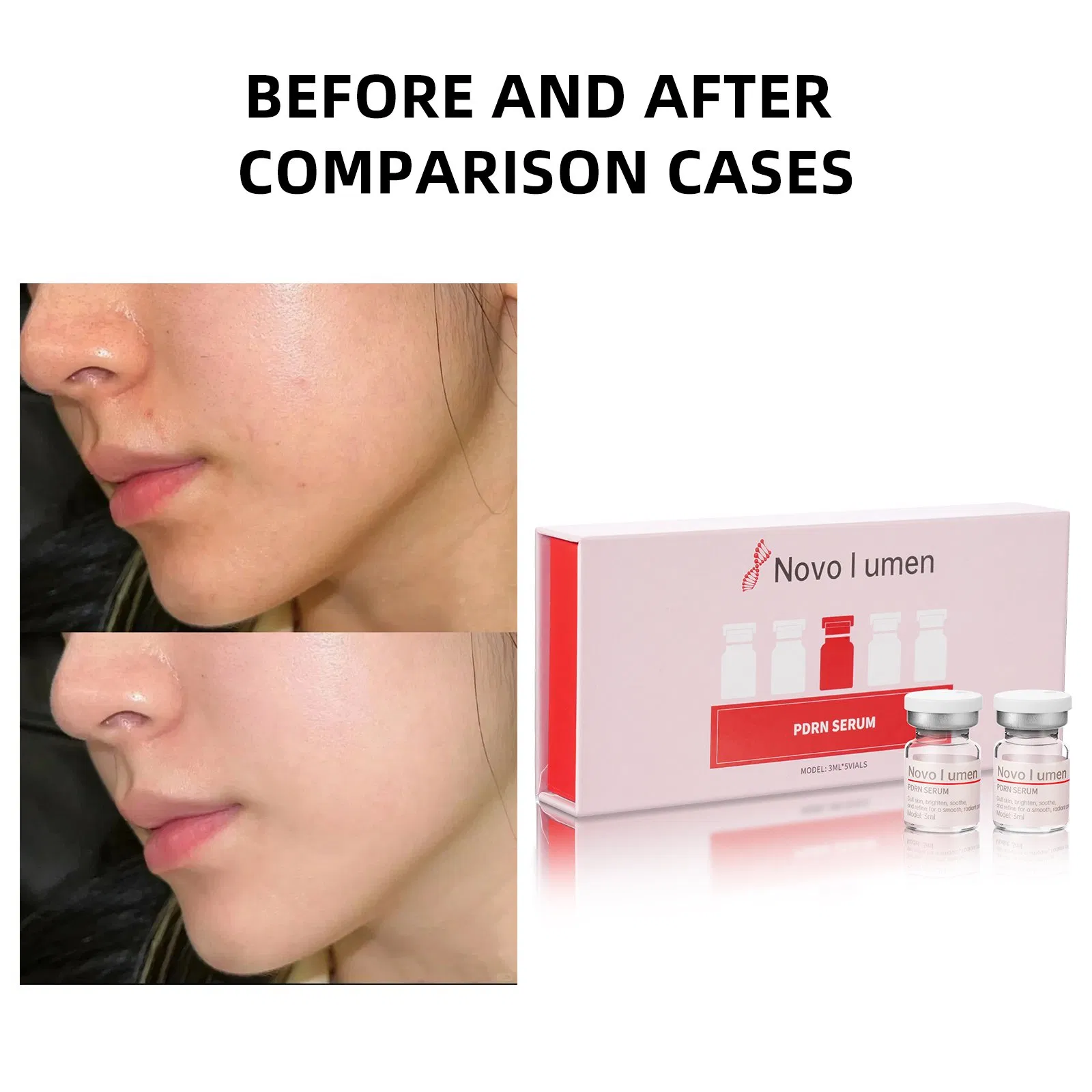 Pdrn Vials Salmon Serum Professional Hydrating Serum Peptides Ampoule Skin Rejuvenating Skincare Kit for Beauty Salon