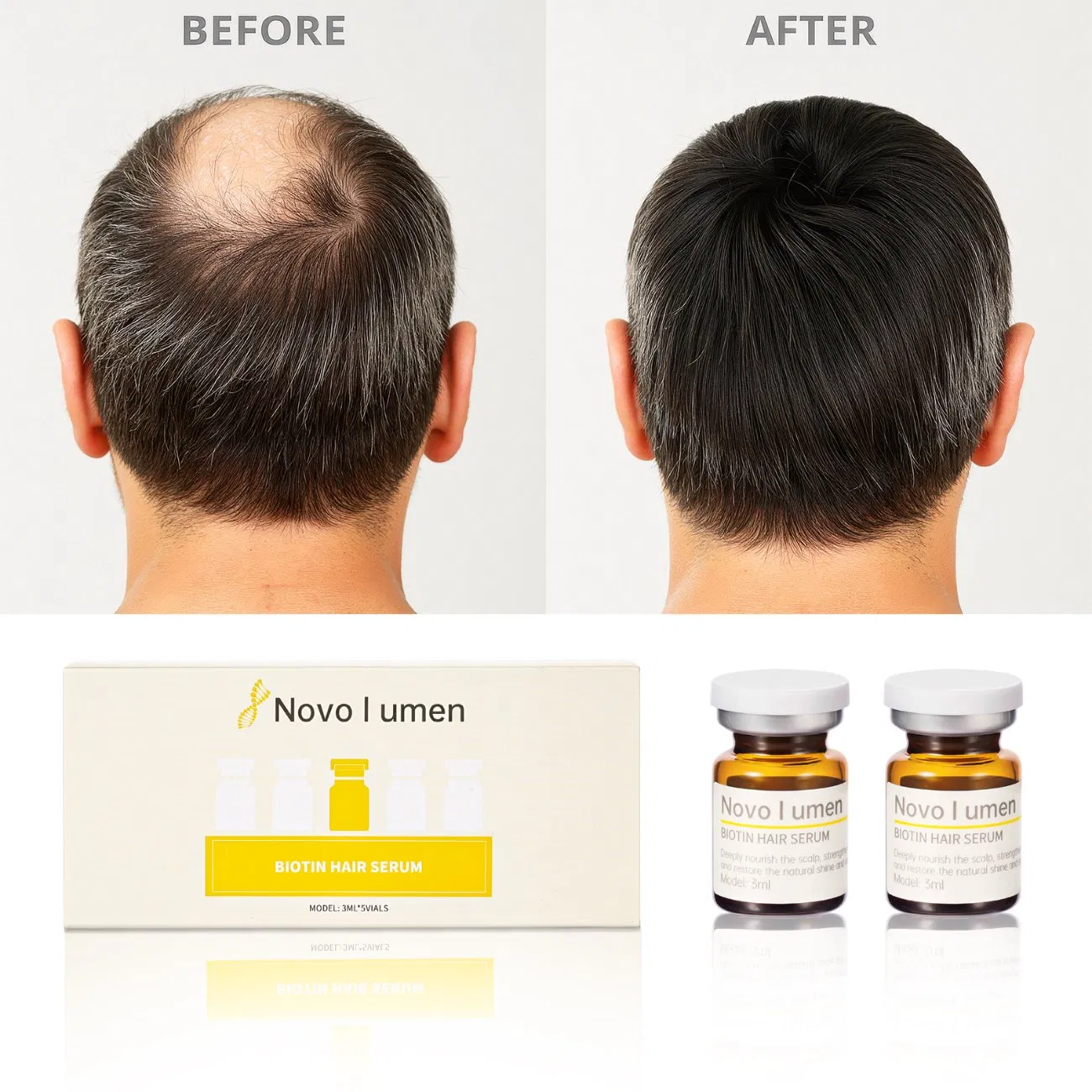 Anti-Hair Loss Scalp Ampoule for Enhanced Hair Repair