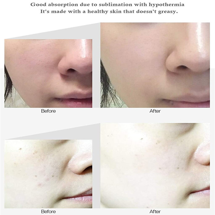 Advanced Custom Korean Skincare Peptide Ampoule Anti-Aging Serum