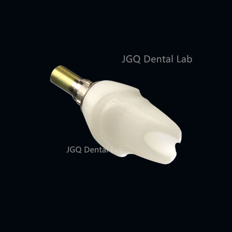 Good Price Affordable Dentures Multi-Unit Abutment Dental Implant System