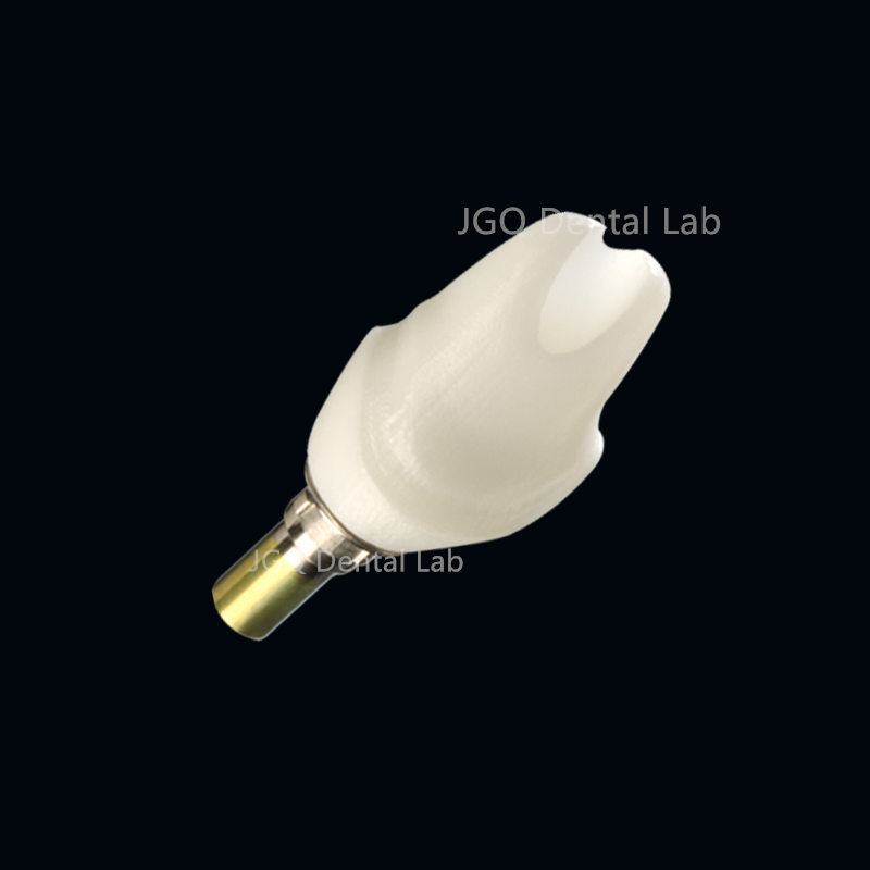 Good Price Affordable Dentures Multi-Unit Abutment Dental Implant System