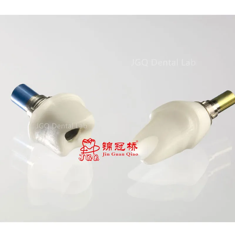 Custom Implant Abutment