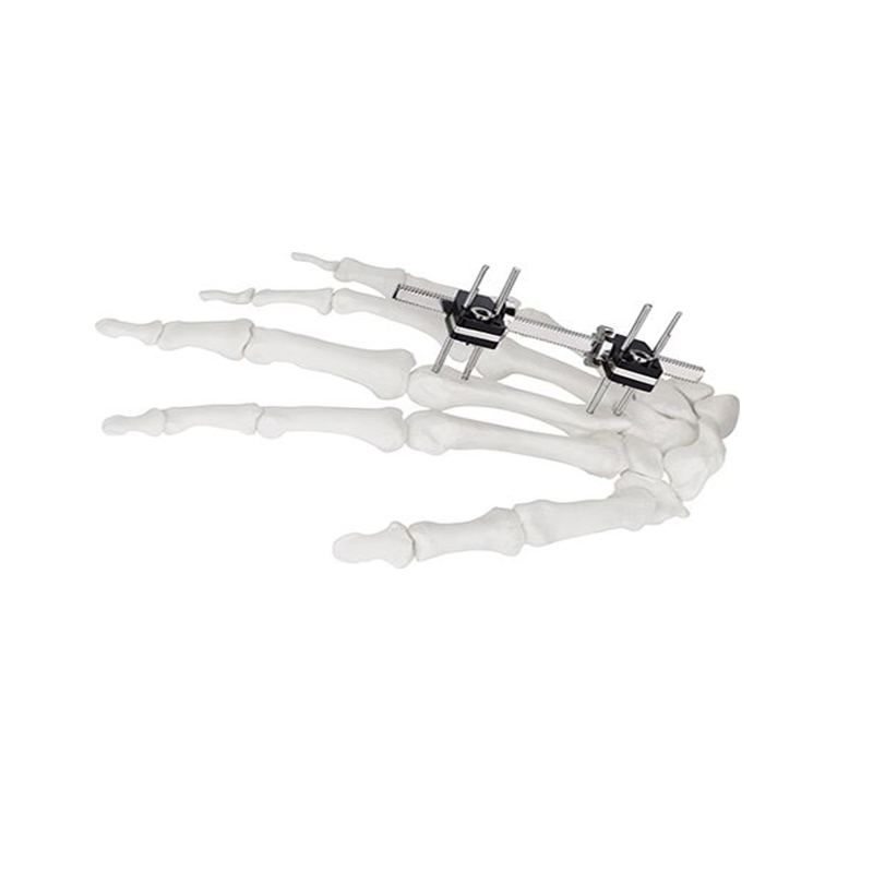 Medical Surgical Equipments Surgical Instruments Mini External Fixator Straight Type