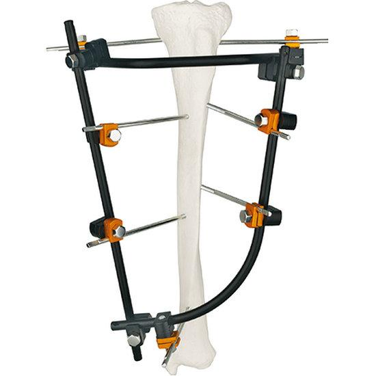 Fracture Fixation Stainless Surgical Instrument Carbon Fiber External Fixator