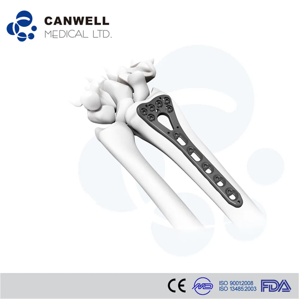 Ao Type Vlp Locking Distal Radius Titanium Bone Plate and Screw Orthopedic Instrument Medical Implants